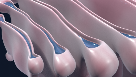 geöffnete Zisternen des Golgi-Apparates
