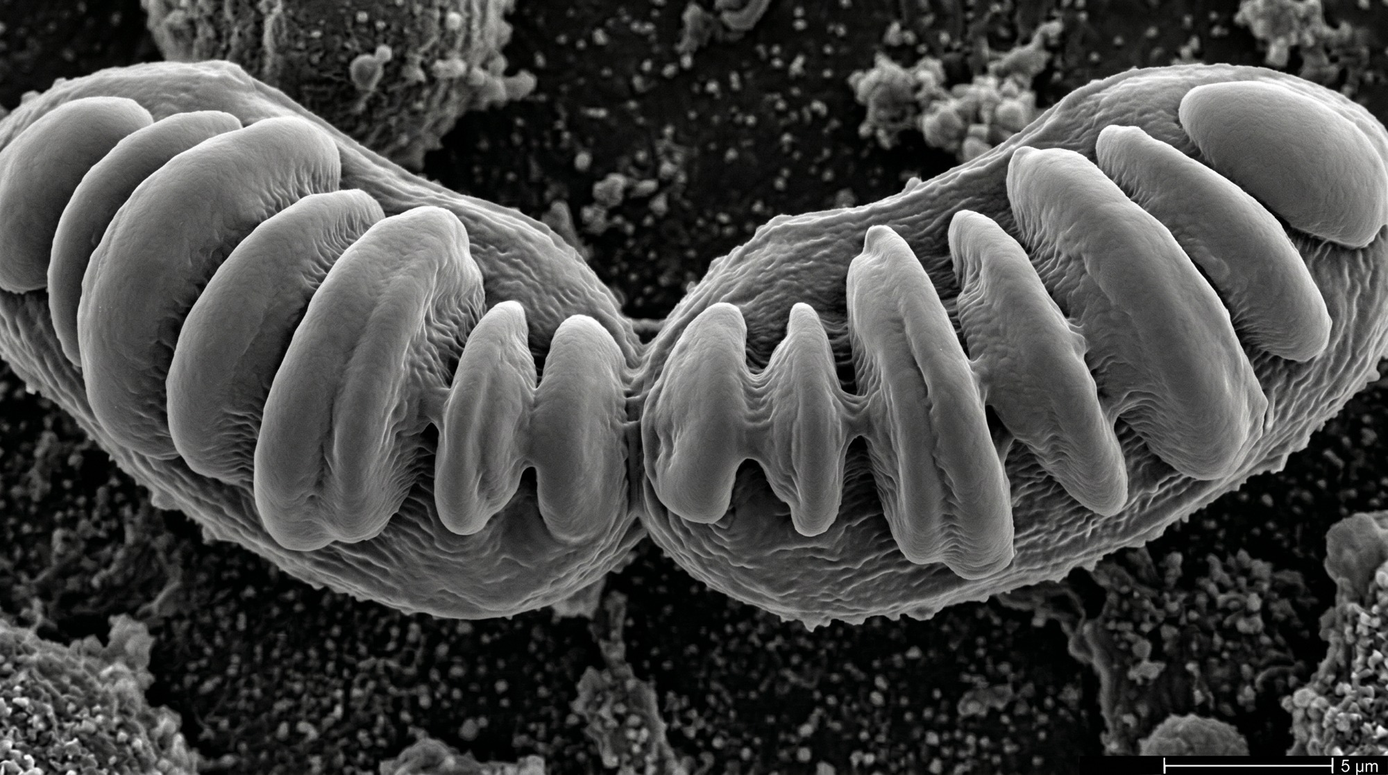MITOCHONDRIEN - Fusion - SEM-Stil
