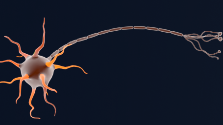 Reizaufnahme an Dendriten einer Nervenzelle Eine schematische Darstellung einer Nervenzelle mit verzweigten Axonen.