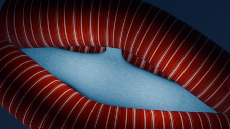 geschlossene Muskelspindel - eingebettet in (extrafusale) Skelettmuskulatur