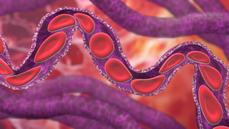 Erythrozyten-Verformung in Kapillaren
